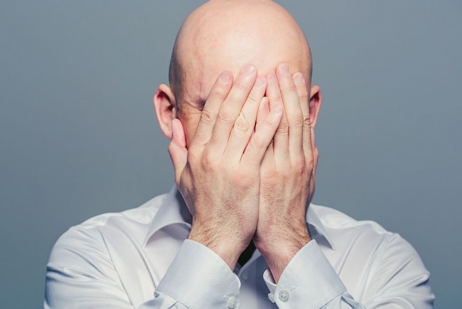 A Gentleman’s Journey of Going Bald